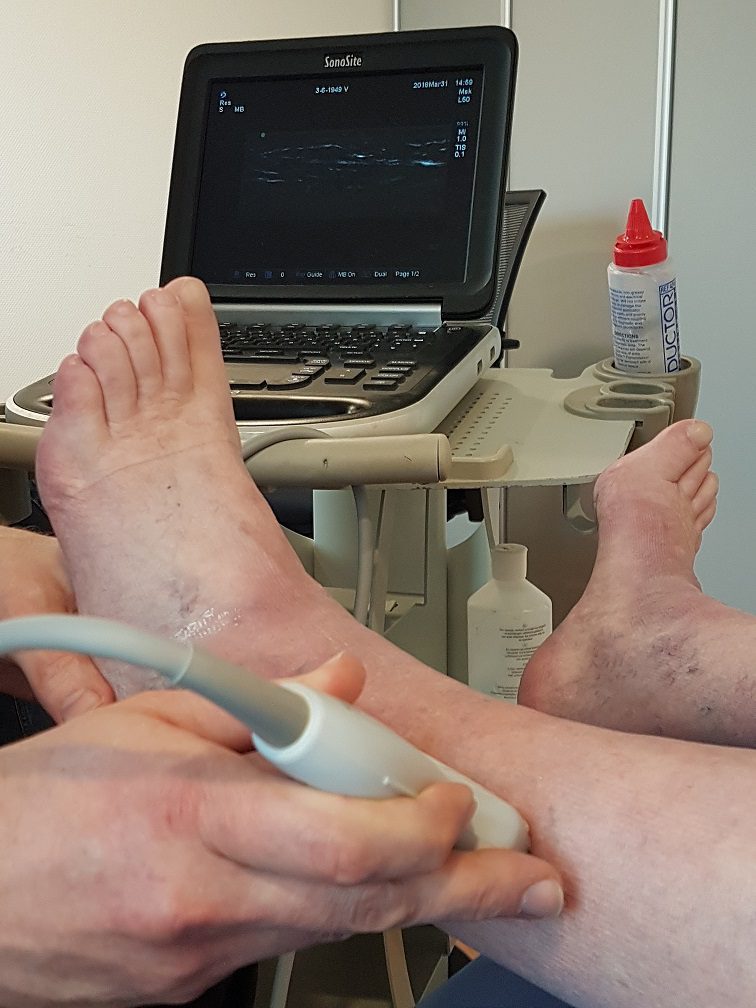 Echografie bij een patiënt