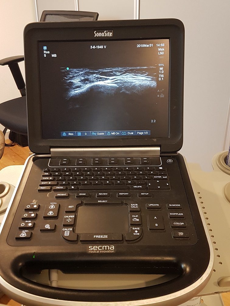 Echografie machine