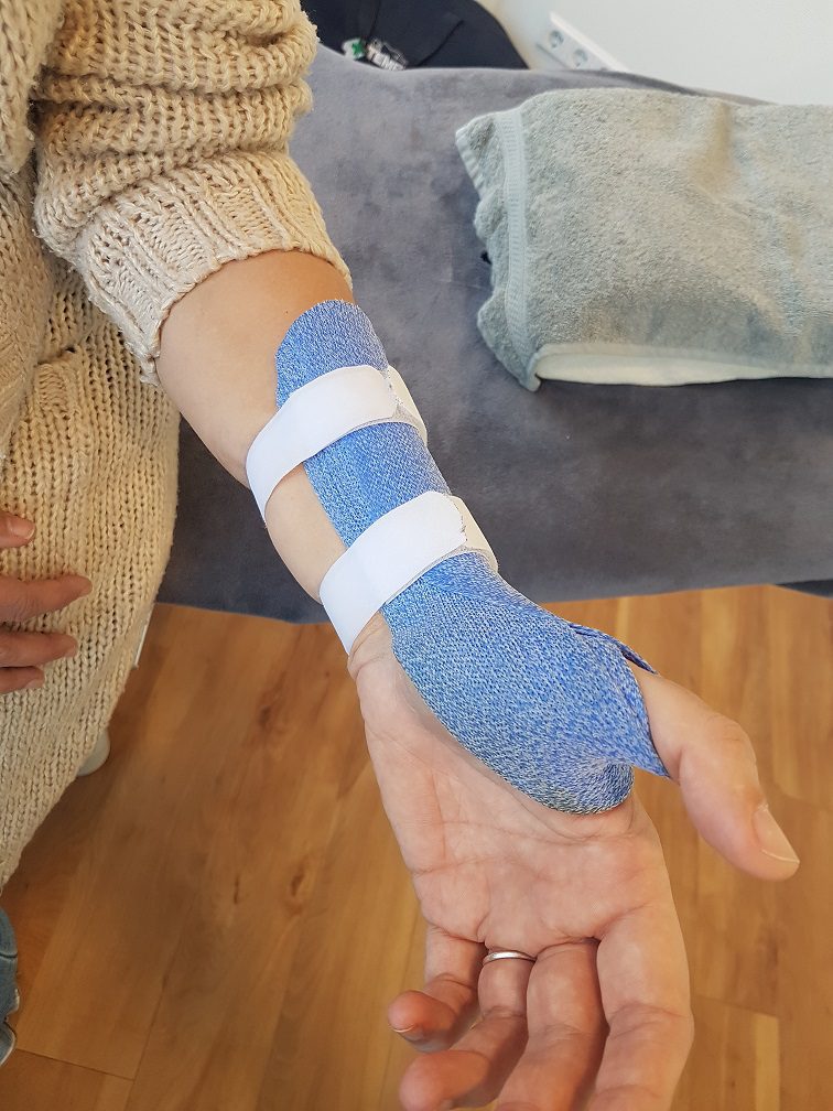 Spalktherapie bij een patiënt